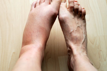 Bas de Compression à Fermeture Éclair – Vosoly™